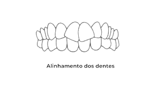 https://odontomedic.com.br/wp-content/uploads/2024/05/Alinhamento-dos-dentes.png