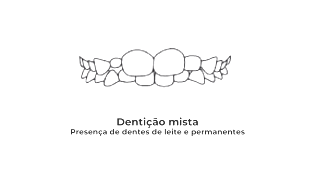 https://odontomedic.com.br/wp-content/uploads/2024/05/Denticao-Mista.png