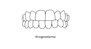 https://odontomedic.com.br/wp-content/uploads/2024/05/Prognatismo.png